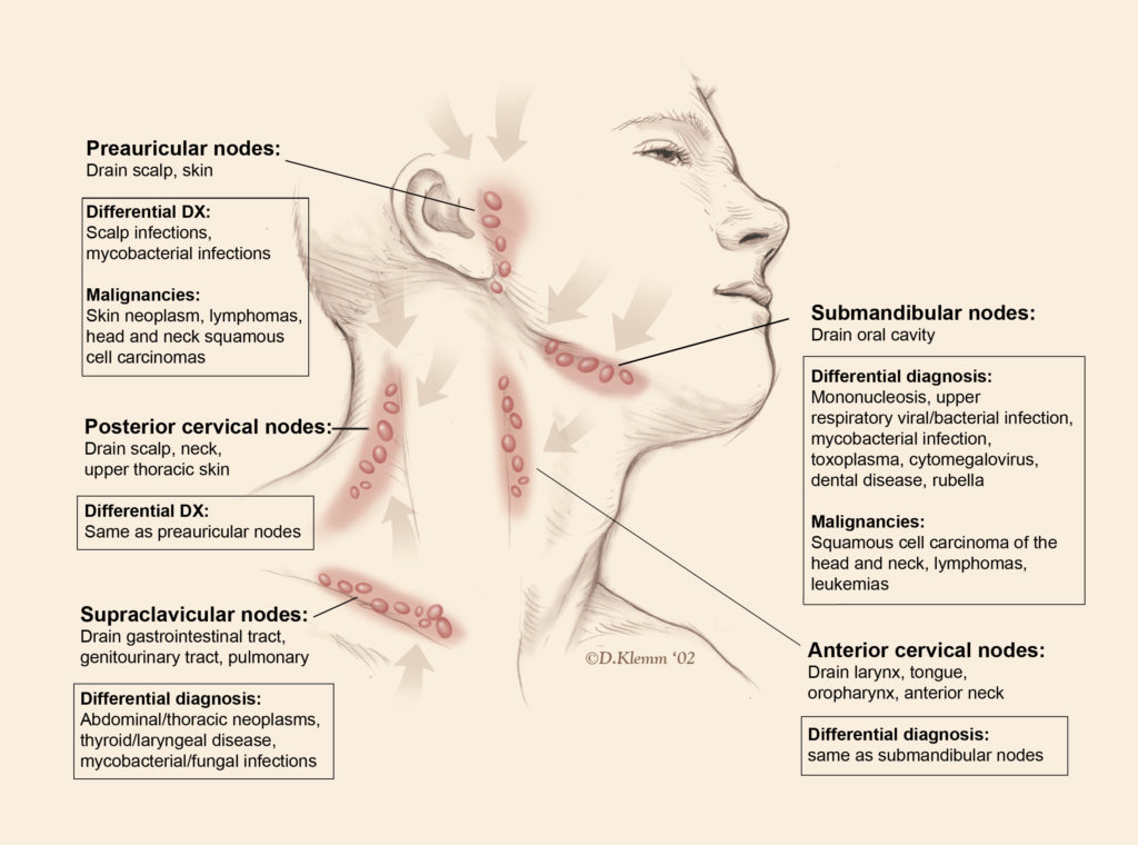 Different sites of lymph nodes where lymphadenopathy can occur