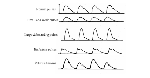 pulse different types