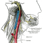 Glossopharyngeal Nerve Distribution is affected in glossopharyngeal neuralgia