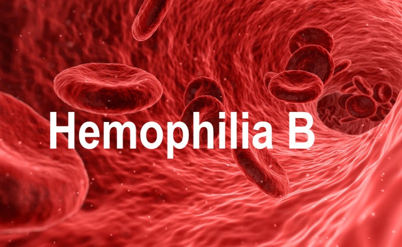 Hemophilia B Presentation and Treatment