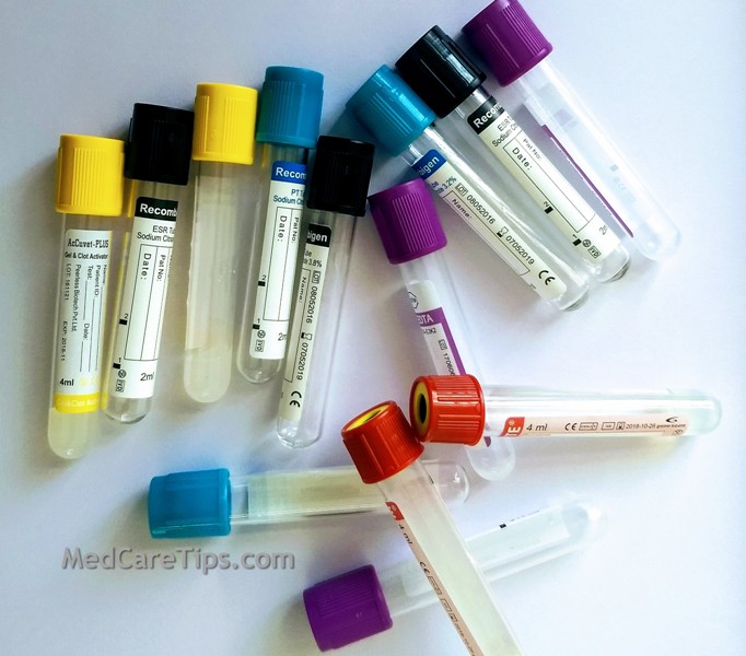 Vacutainer Tube Colors Chart