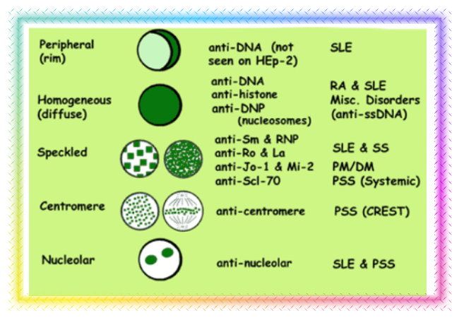 Antinuclear antibodies test staining patterns