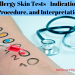 Allergy Skin Tests - Indications, Procedure, and Interpretation